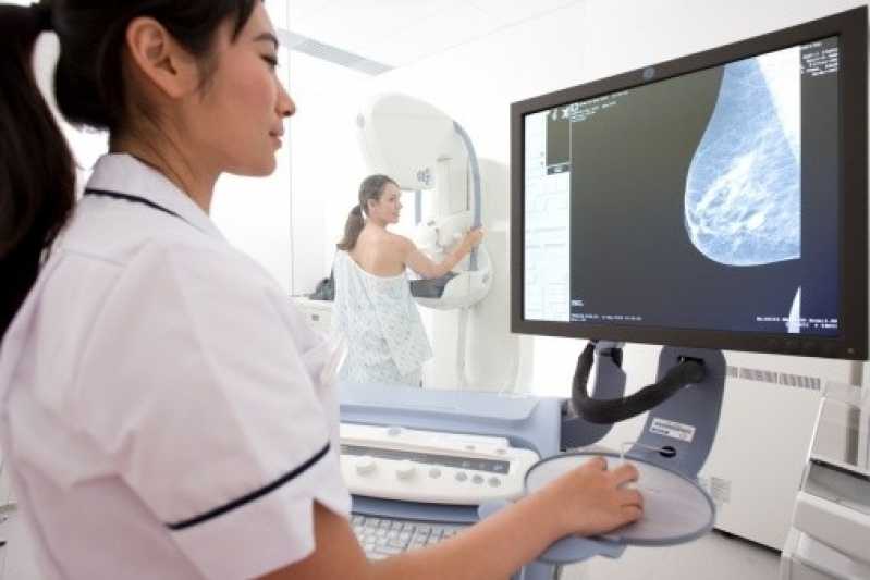 Clinica de Exame de Mamografia Convencional Carapicuíba - Exame de Mamografia Digital