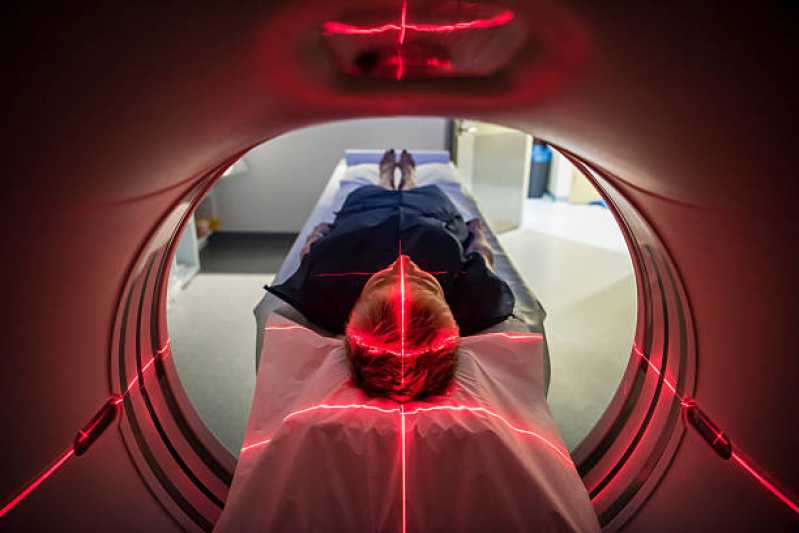 Clinica de Exame de Tomografia Computadorizada Butantã - Exame de Tomografia do Ombro