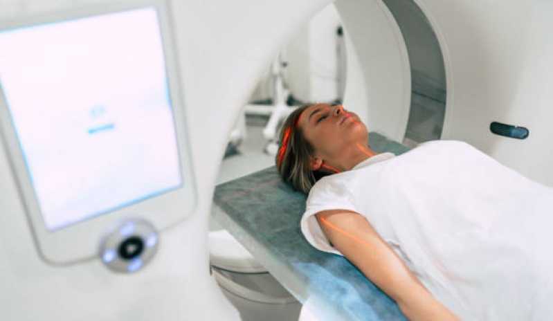 Clinica de Exame Tomografia Itaquaquecetuba - Exame de Tomografia do Crânio
