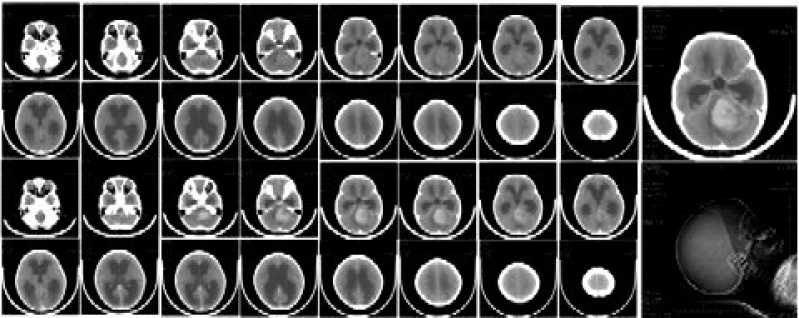 Clínica Que Faz Exame Ressonância Magnética Francisco Morato - Exame Rm Cranio