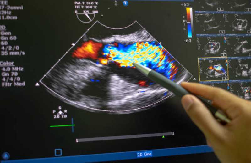 Clínica Que Faz Exame Ultrassonografia Pelvico Centro - Exame Ultrassonografia Abdominal Total