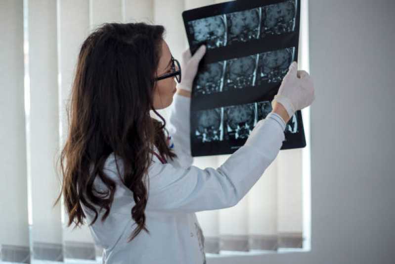 Exame de Radiografia Marcar Itapecerica da Serra - Exame Radiografia de Torax