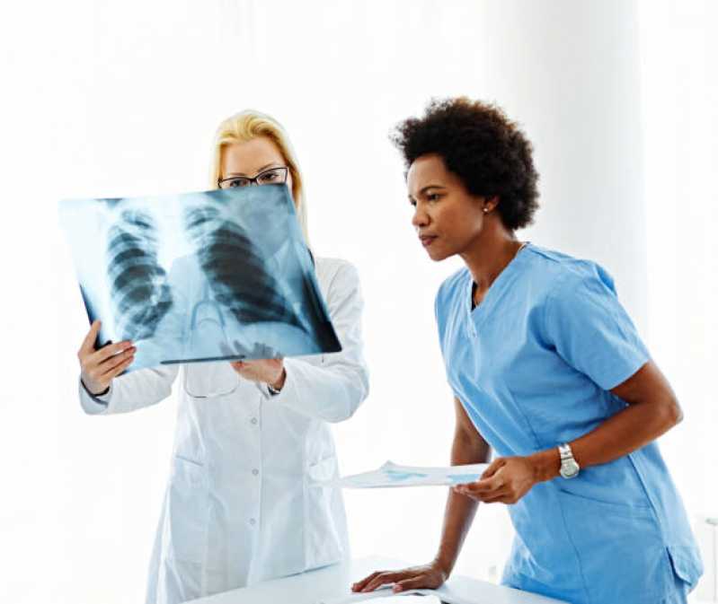 Exame de Radiografia Butantã - Exame de Raio X do Pulmão