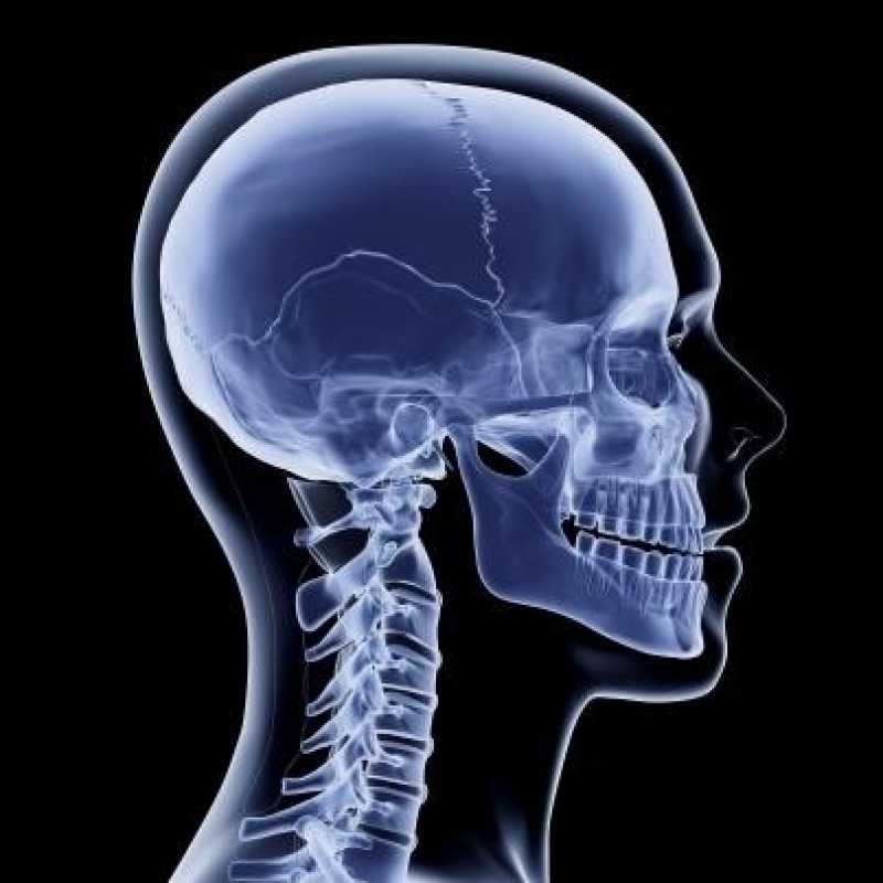 Exame de Ressonância Agendar Sé - Exame Ressonância Magnética do Crânio
