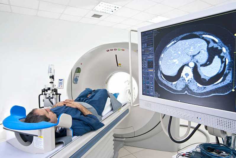 Exame de Tomografia Computadorizada Vargem Grande Paulista - Exame Tomografia do Pulmão