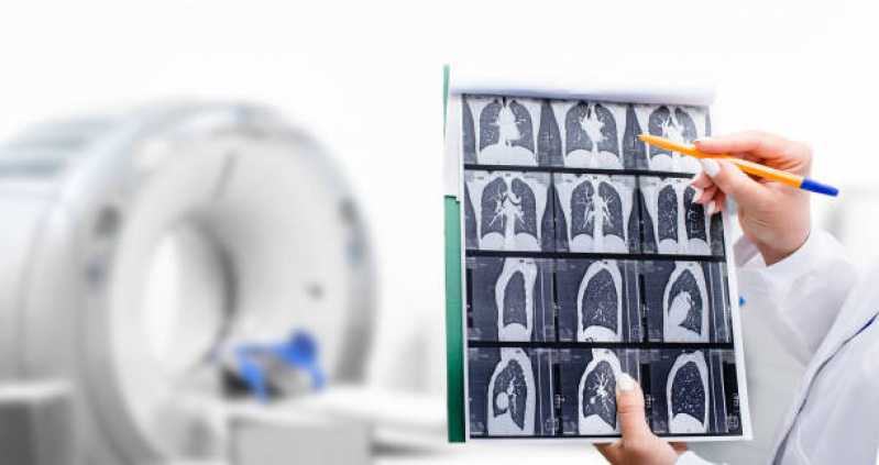 Exame de Tomografia do Punho Marcar Previdência - Exame Tomografia do Pulmão