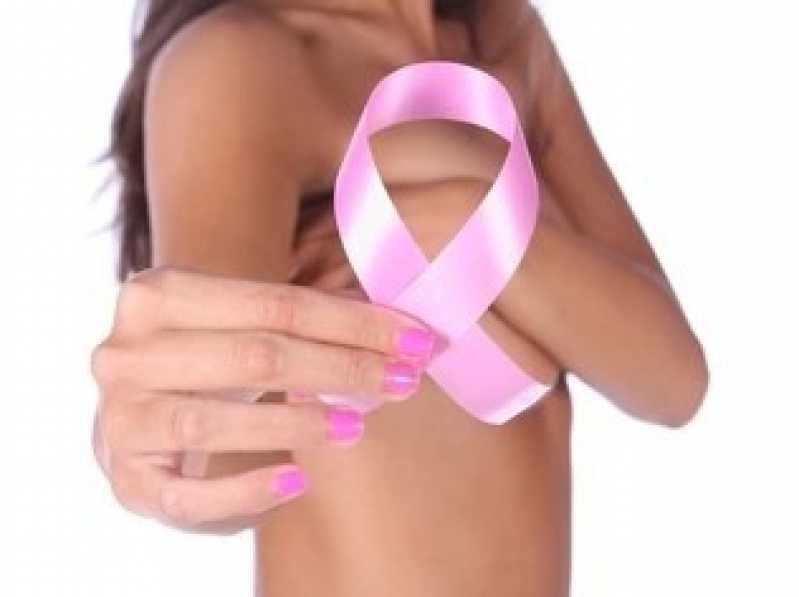 Exame Mamografia Bilateral São Paulo - Exame de Mamografia