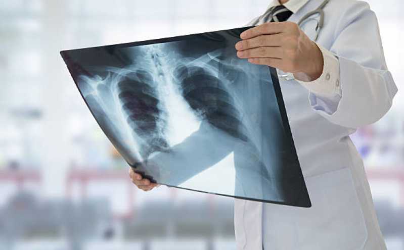 Exame Radiografia de Torax Vila São Domingos - Exame de Radiografia