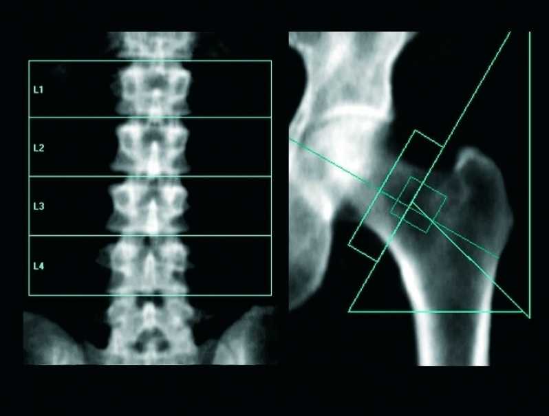 Exame Ressonância Itaquaquecetuba - Exame Ressonância Magnética do Crânio