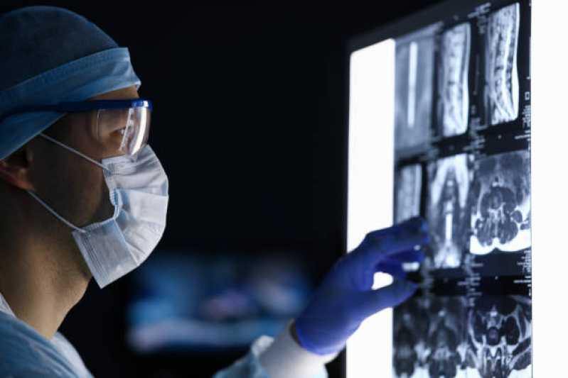 Exame Rx Marcar Itapecerica da Serra - Exame de Radiografia