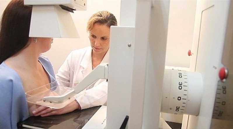 Exames Mamografia Convencional Marcar Santa Cecília - Exame de Mamografia