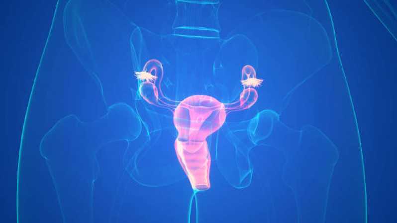 Histerossalpingografia Endometriose Marcar Guararema - Histerossalpingografia Sedação