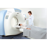 clinica de exame de mamografia bilateral Vila Gomes