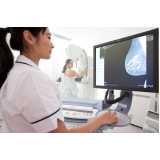 clinica de exame de mamografia convencional Santa Cecília