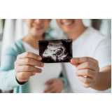 clínica que faz exame de ultrassonografia Santa Cecília