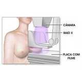 exame de mamografia Jardim Christie