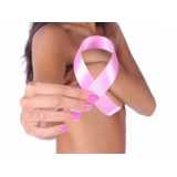 exame mamografia bilateral Santa Cecília