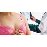exame mamografia convencional bilateral Aclimação