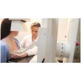 exame mamografia digital marcar Santa Cecília