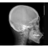 exame ressonância magnética do crânio Vila Pirajussara
