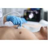 exame ultrassom abdominal total agendar Jandira