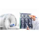 exames-de-tomografia-exame-de-tomografia-computadorizada-clinica-de-exame-de-tomografia-da-mao-barueri